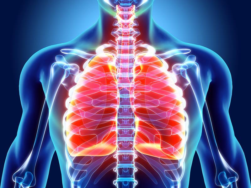 xray of human chest showing lungs