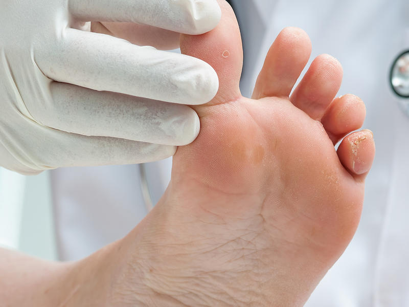 Gloved hand of doctor touching big toe of patient's foot