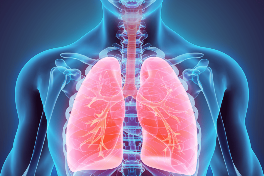 Photo of lung screening image