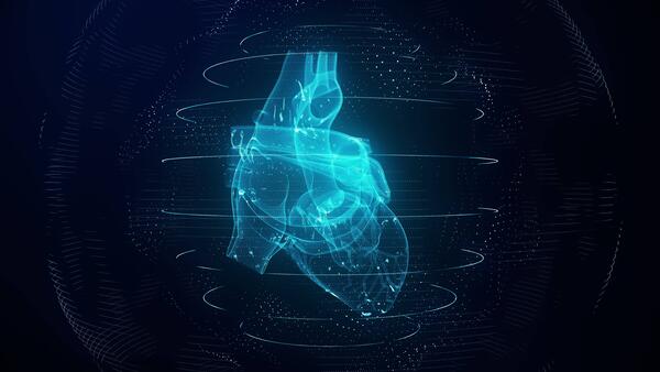Cardiac imaging photo