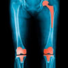 Xray of hip and knee