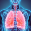 Photo of lung screening image