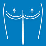icon of buttock augmentation surgery