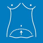 icon of tummy tuck surgery