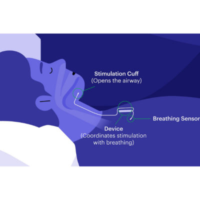 Sleep apnea photo